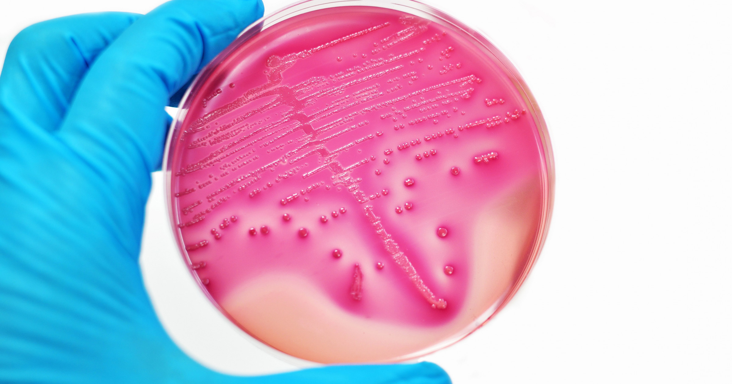 Эскулап. Рецидивирующая ИМП: новая роль Escherichia coli