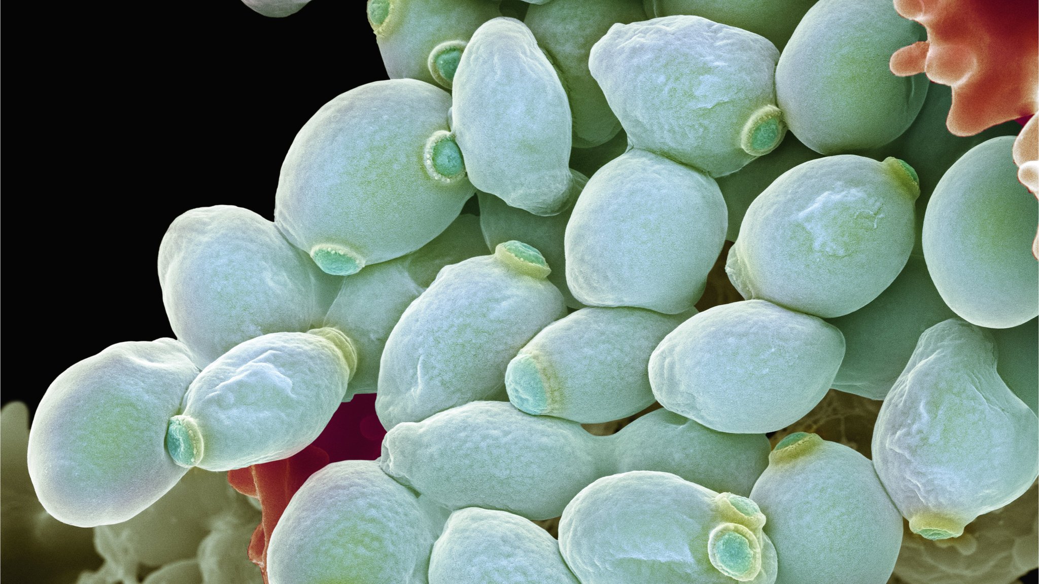 Споры candida. Дрожжеподобный гриб Candida albicans. Кандида альбиканс под микроскопом. Грибы рода кандида под микроскопом.